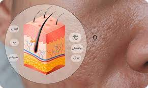 انواع پوست و مراقبت از آن